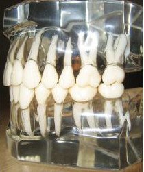 human-teeth-model.jpg