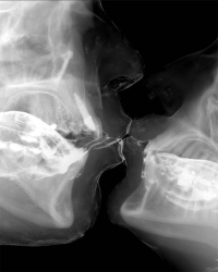 x-ray-kiss.jpg